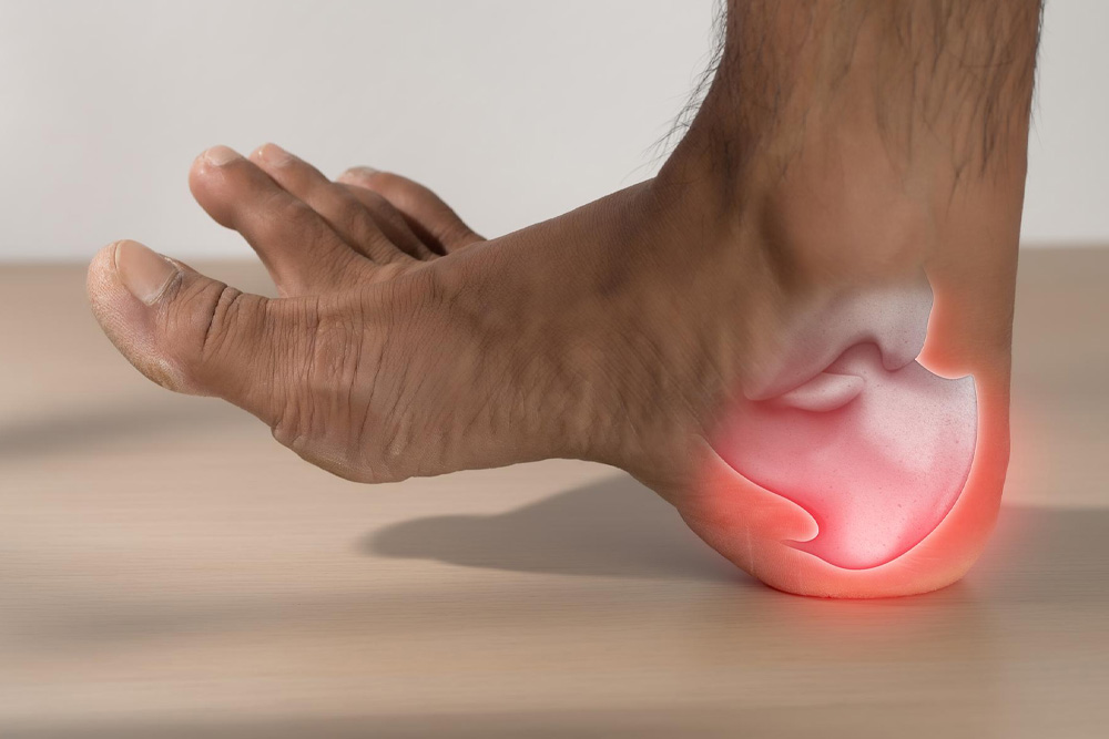 Patient receiving shockwave therapy treatment for chronic heel pain and plantar fasciitis relief